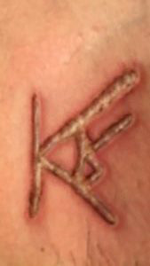 Cicatriz com a marca KR